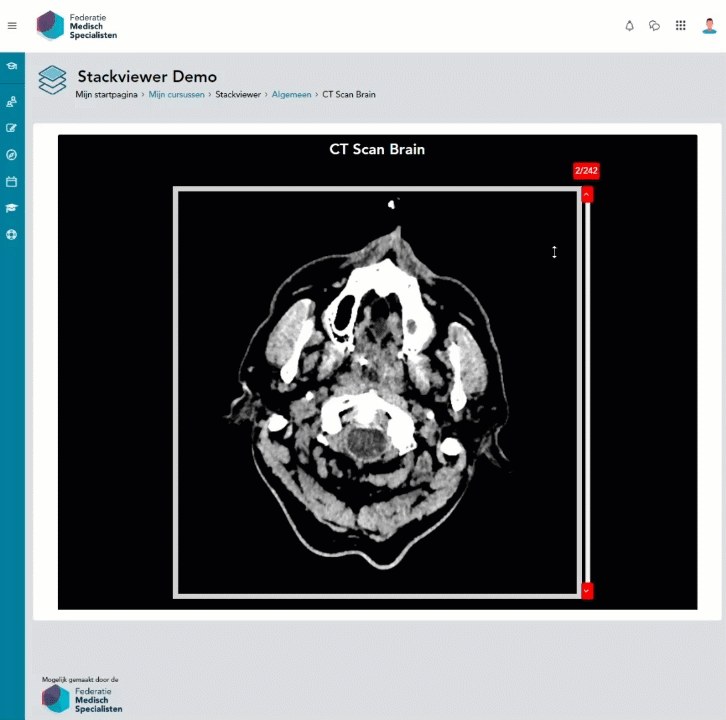 Filter stackview